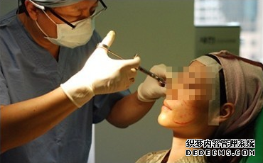 【真人案例】填充脂肪就像做脸部按摩一样,看下我的感受吧